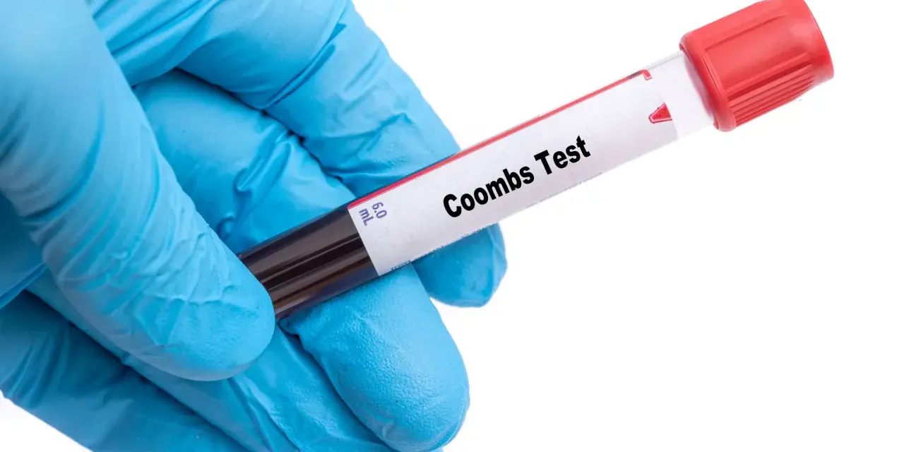 Rękawiczka medyczna trzyma probówkę z krwią do badania. Na etykiecie widnieje napis "Coombs Test", wskazujący na wykonanie odczynu Coombsa.