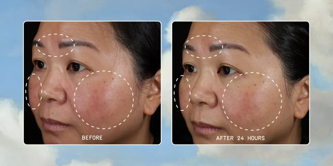 Before and after images show a woman's face with areas of damaged skin barrier highlighted. After 24 hours, the skin appears calmer and less irritated.