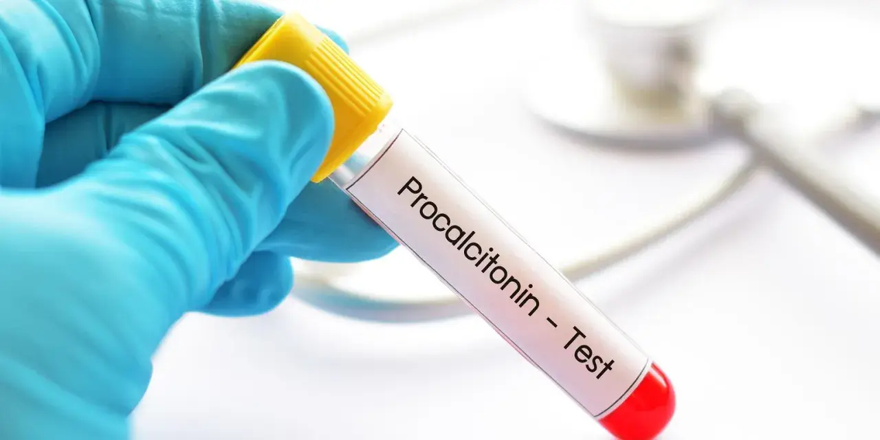 Ręka w niebieskiej rękawiczce trzyma probówkę z napisem "Procalcitonin - Test". To ważny pct.