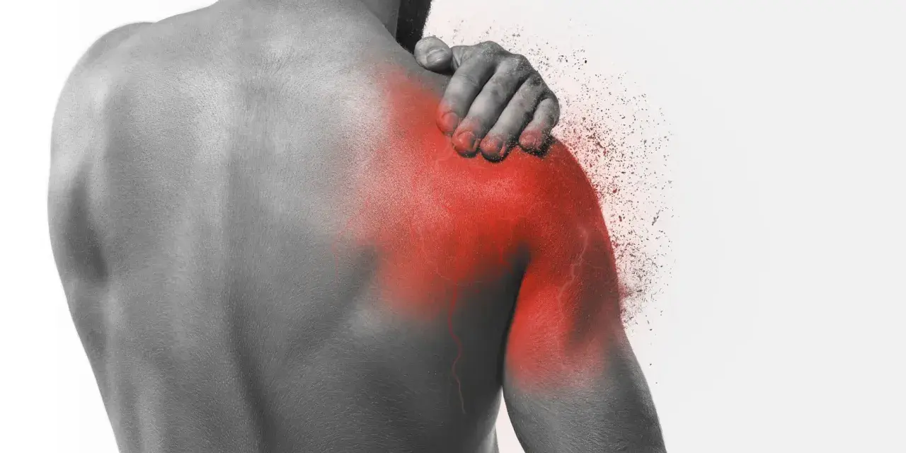 Ból barku, objaw capsulitis adhesiva, zaznaczony czerwienią.