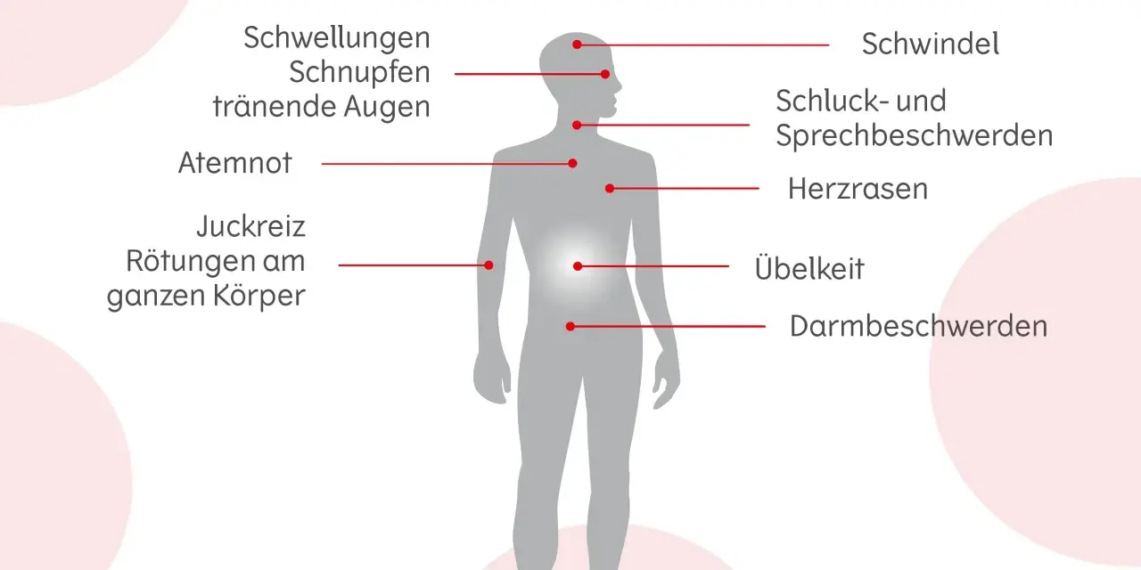 Allergie Symptome: So erkennen Sie gefährliche Reaktionen rechtzeitig