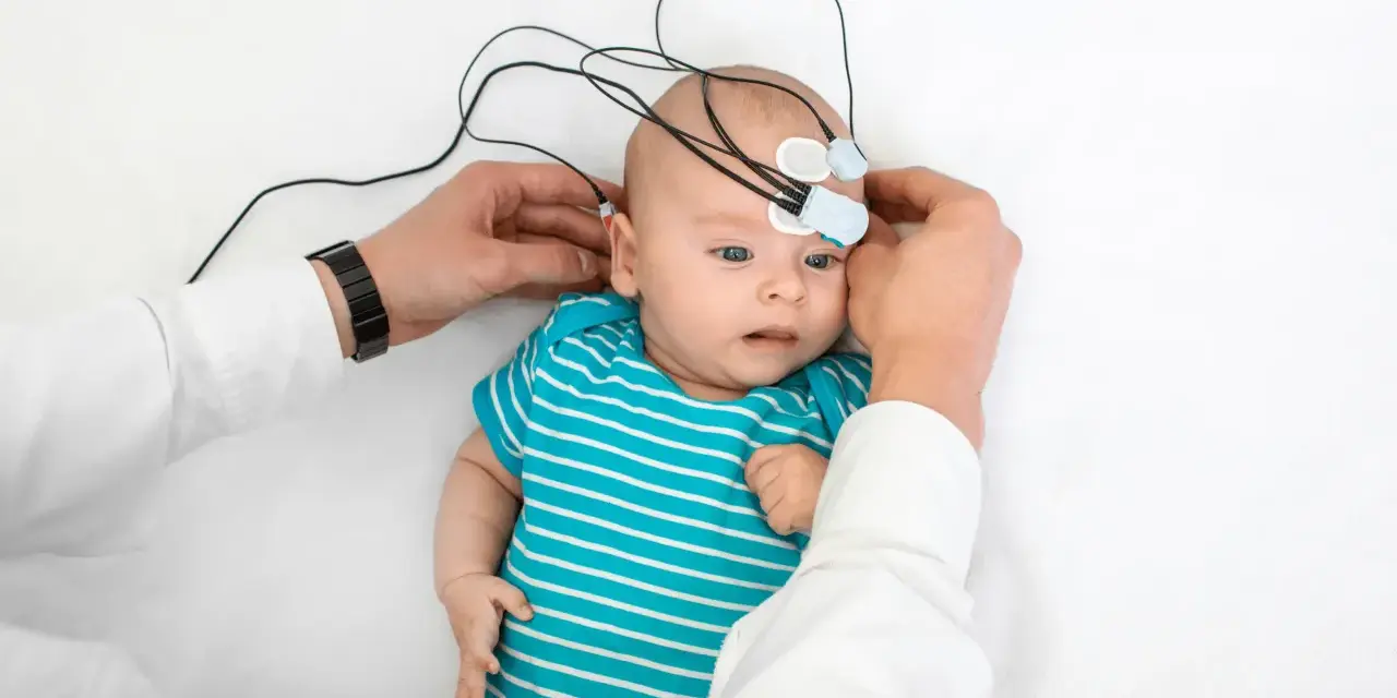 Niemowlę z elektrodami na głowie, przygotowywane do badania słuchu. To ważny krok w diagnostyce, by wcześnie wykryć potrzebę zastosowania aparatu słuchowego dla niemowlaka.