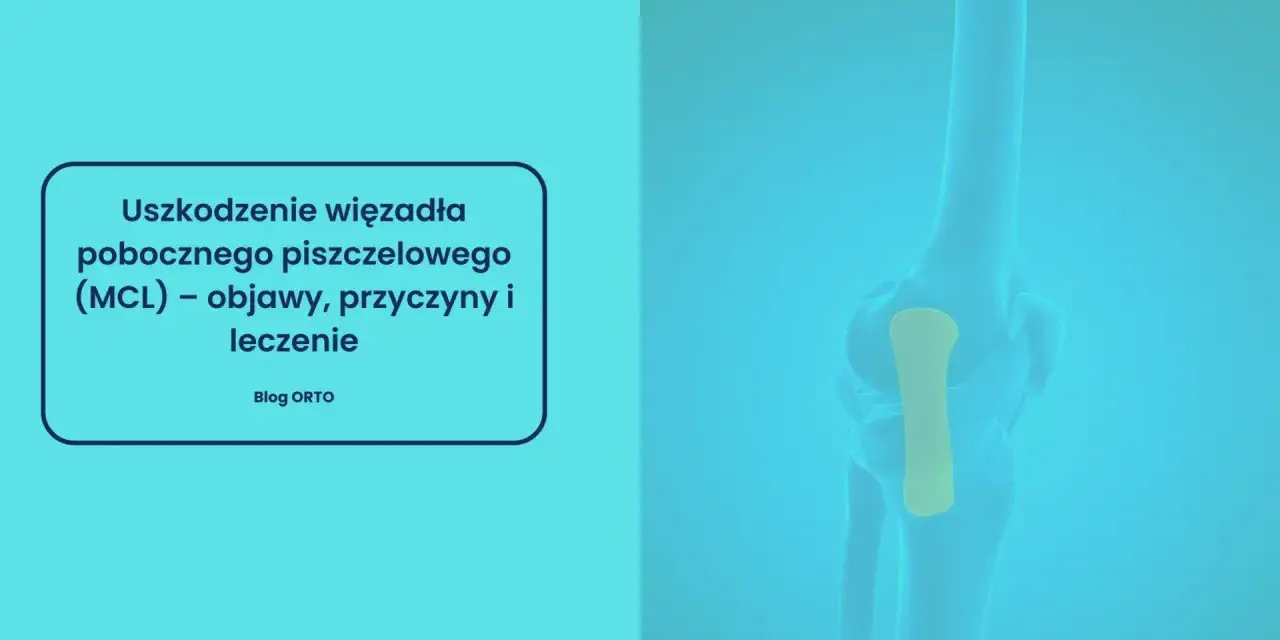 Anatomia kolana z zaznaczonym więzadłem pobocznym piszczelowym (MCL). Grafika informuje o uszkodzeniach, objawach i leczeniu.