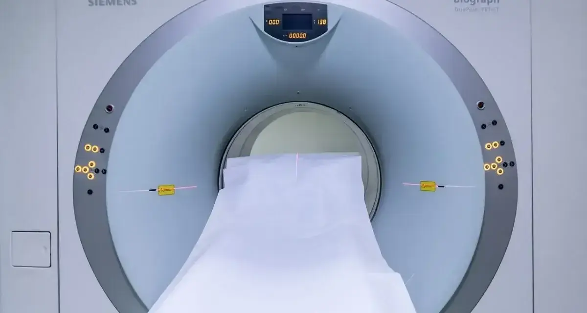 Tomograf komputerowy Siemens Biograph. Badanie może pomóc wykryć nerwiak nerwu słuchowego objawy.