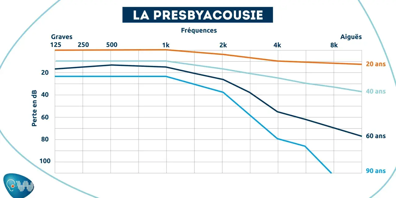 Graphique montrant la perte auditive en décibels selon l'âge et la fréquence. À partir de 20 dB, on entend moins bien.