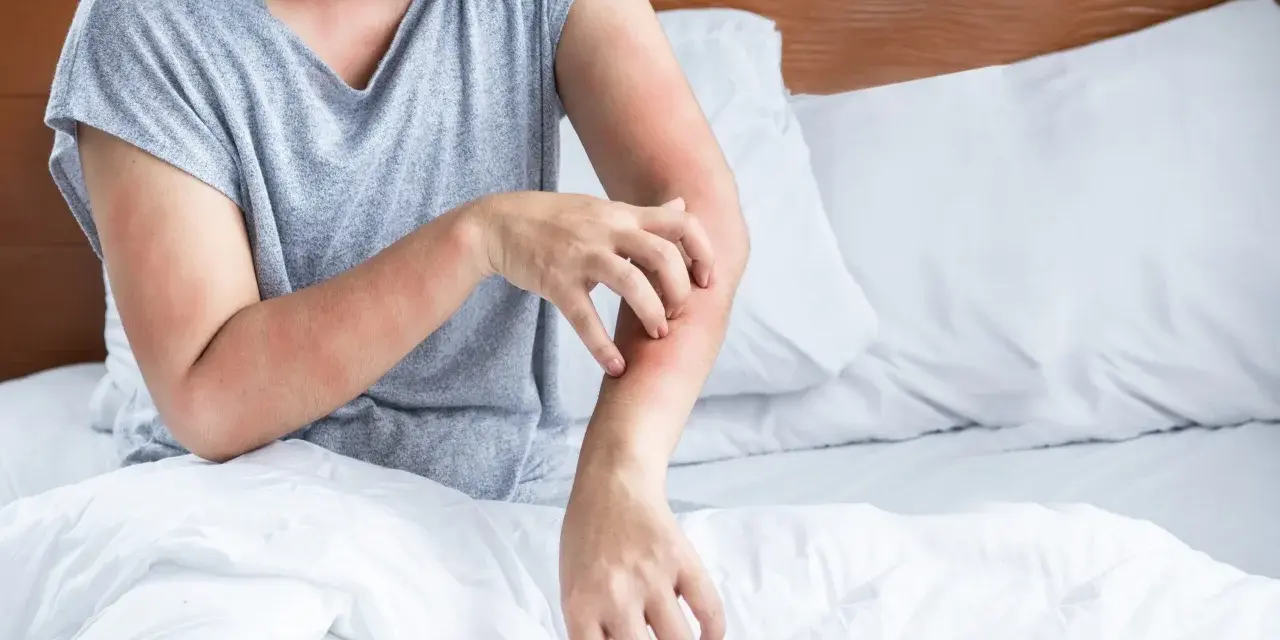 Frau kratzt sich am Arm, rote Hautstellen. Juckende Haut kann ein Symptom der Wechseljahre sein.