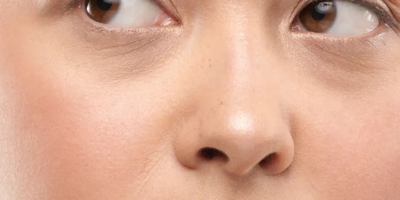 Nahaufnahme eines Gesichts mit braunen Augen und einer normalen Hautstruktur, die leichte Falten um die Augen zeigt.