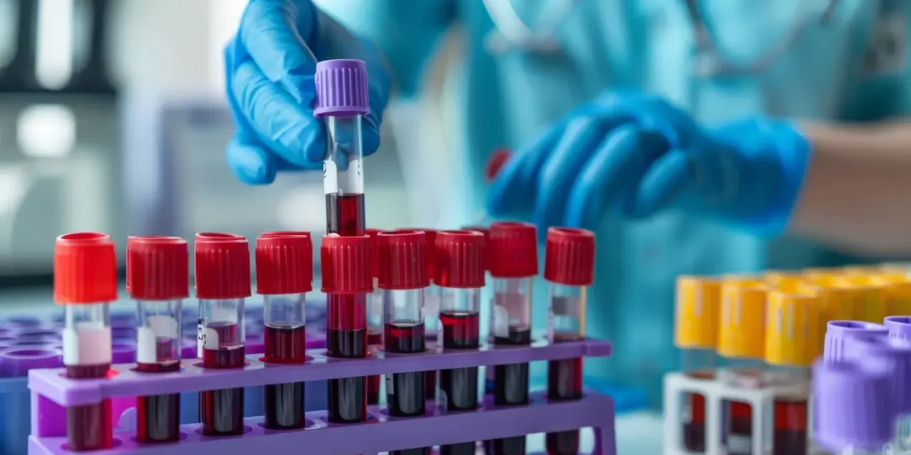 Laborant w niebieskich rękawiczkach przygotowuje próbki krwi do badań immunologicznych.