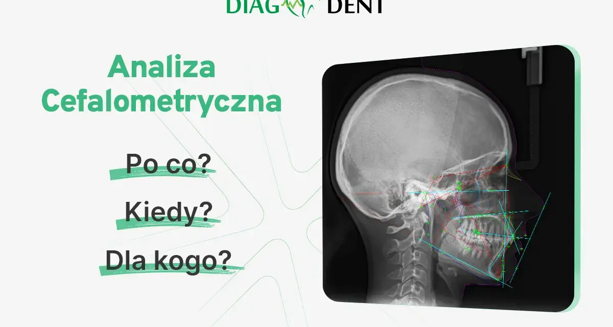 Analiza cefalometryczna: zdjęcie RTG czaszki z naniesionymi liniami i kątami. Pytania: Po co? Kiedy? Dla kogo?