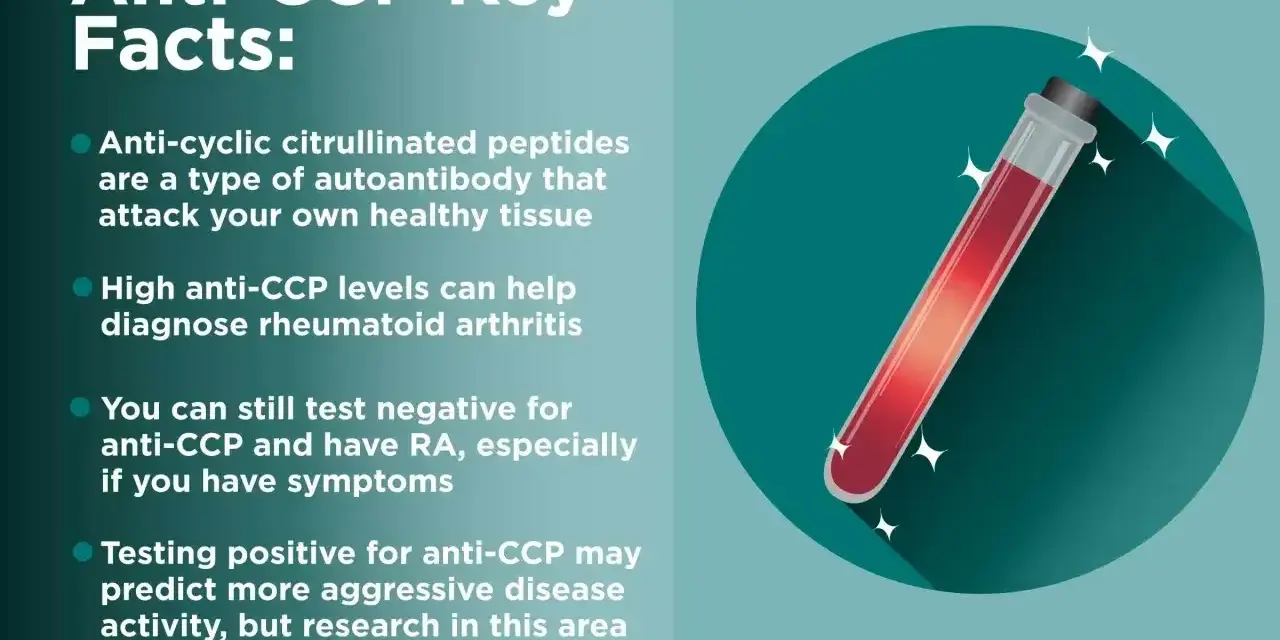 Kluczowe fakty o anty-CCP: przeciwciała atakujące tkanki, wysoki poziom anty-CCP pomaga diagnozować RZS. Test anty-CCP może przewidywać agresywność choroby.