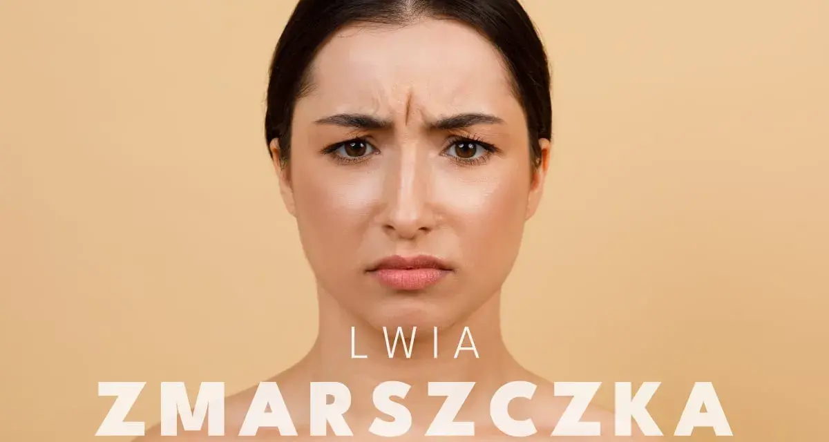Kobieta z wyraźną lwia zmarszczka między brwiami. Dowiedz się, jak pozbyć się lwiej zmarszczki i odzyskać gładką skórę.