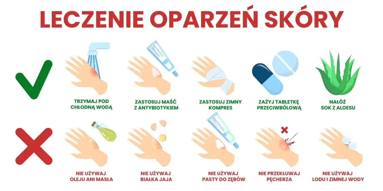 Co na oparzenie wrzątkiem domowe sposoby: chłodna woda, maść z antybiotykiem, zimny kompres, aloes. Unikaj masła, jajka, pasty do zębów, lodu.