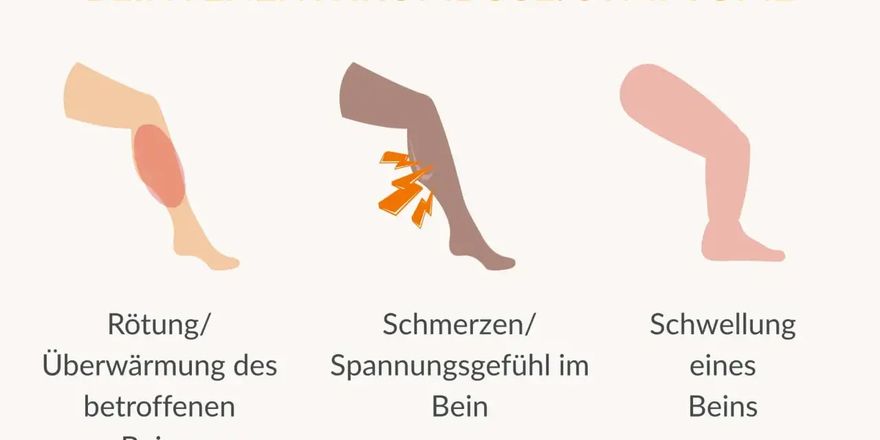 Rötung, Schmerzen und Schwellung am Bein sind Symptome, die auf eine Thrombose hinweisen können. Achte auf diese Anzeichen!