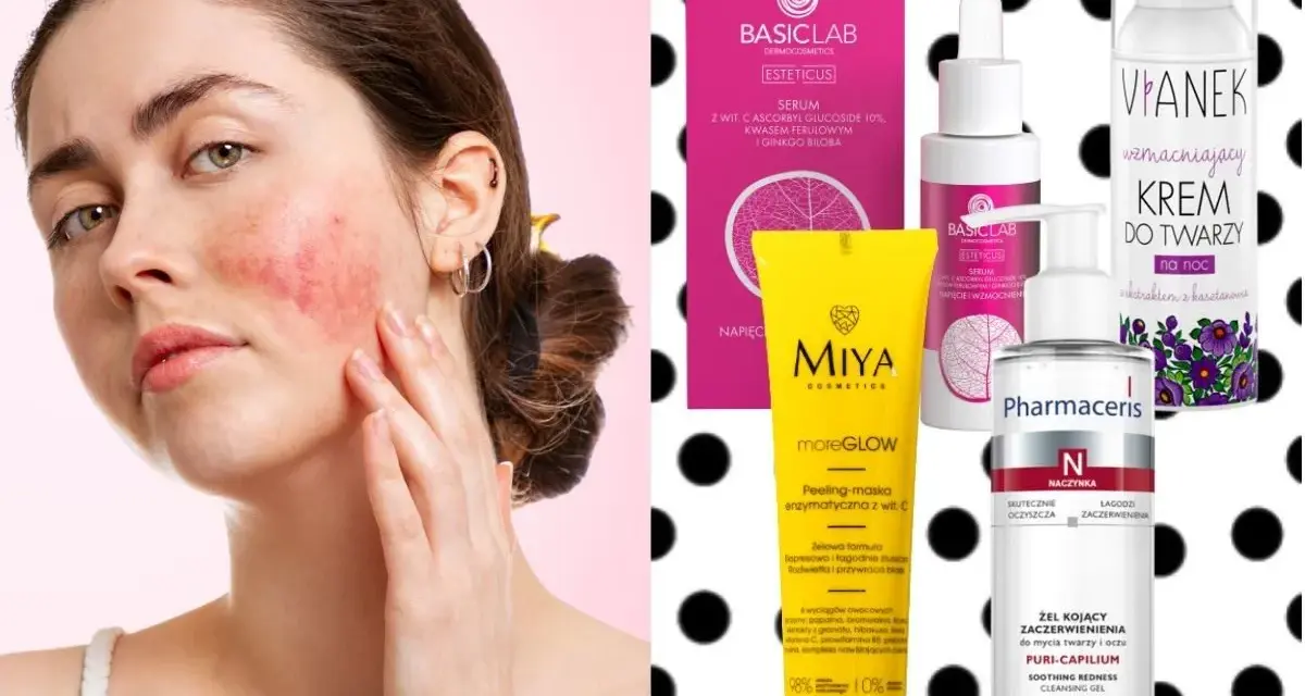 Kobieta z cerą naczynkową dotyka policzka. Obok kosmetyki: krem, serum, peeling i żel. Jaki olej do cery naczynkowej wybrać?