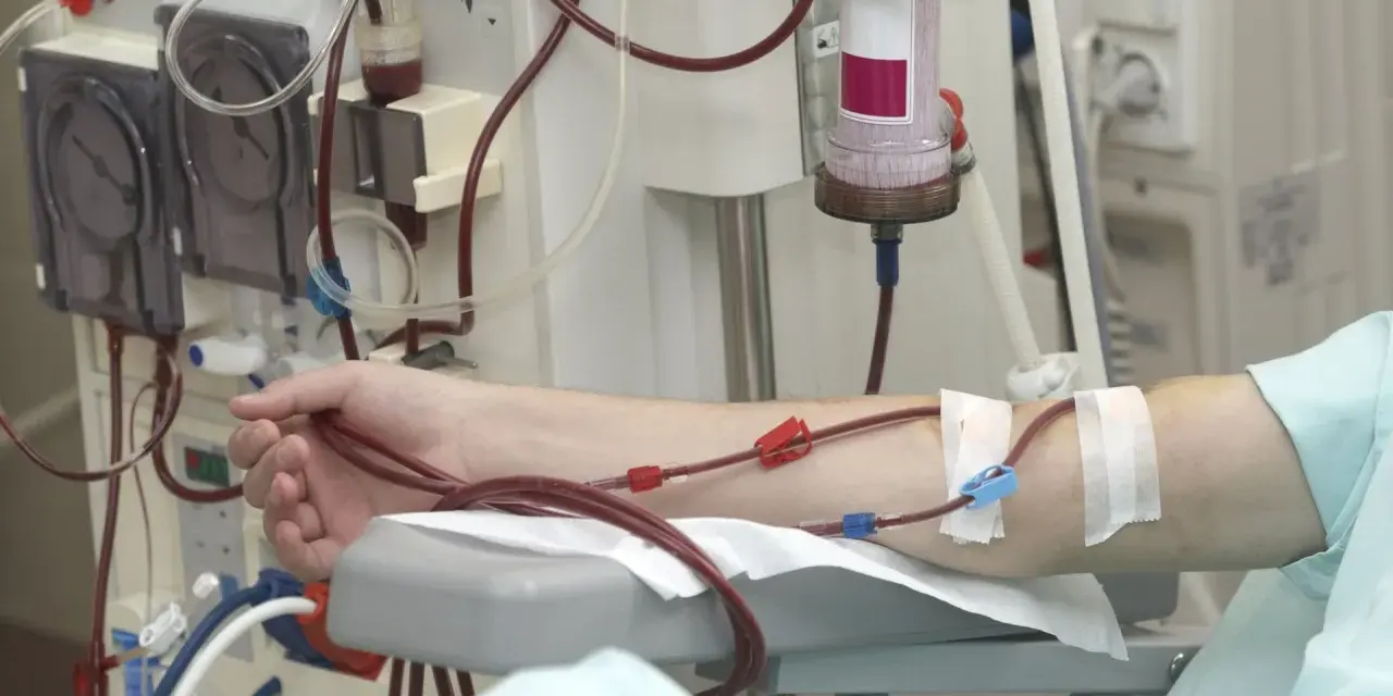 Ramię pacjenta podłączone do maszyny do dializy. Czerwone wężyki prowadzą krew do aparatu, który oczyszcza ją podczas dializy.