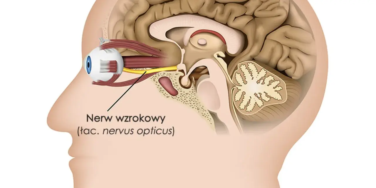 Przekrój głowy z okiem i nerwem wzrokowym. Czy zapalenie nerwu wzrokowego zawsze oznacza SM? Niekoniecznie, ale warto zbadać przyczynę.
