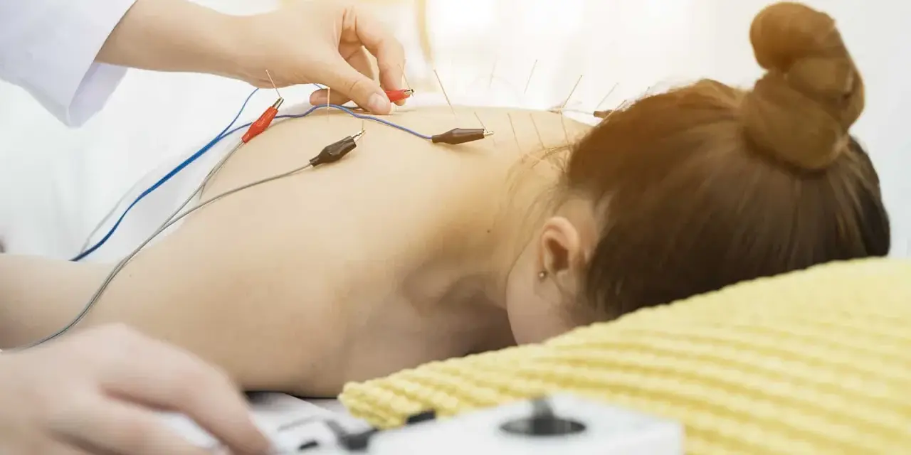 Elektroakupunktura: igły z elektrodami na plecach pacjentki. Choć metoda ta ma wiele zalet, warto pamiętać o potencjalnych skutkach ubocznych.