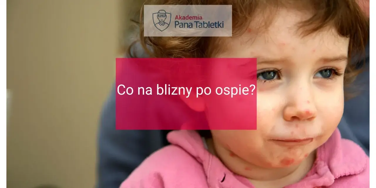 Twarz dziecka z widocznymi śladami po ospie. Napis "Co na blizny po ospie?" sugeruje poszukiwanie rozwiązań.