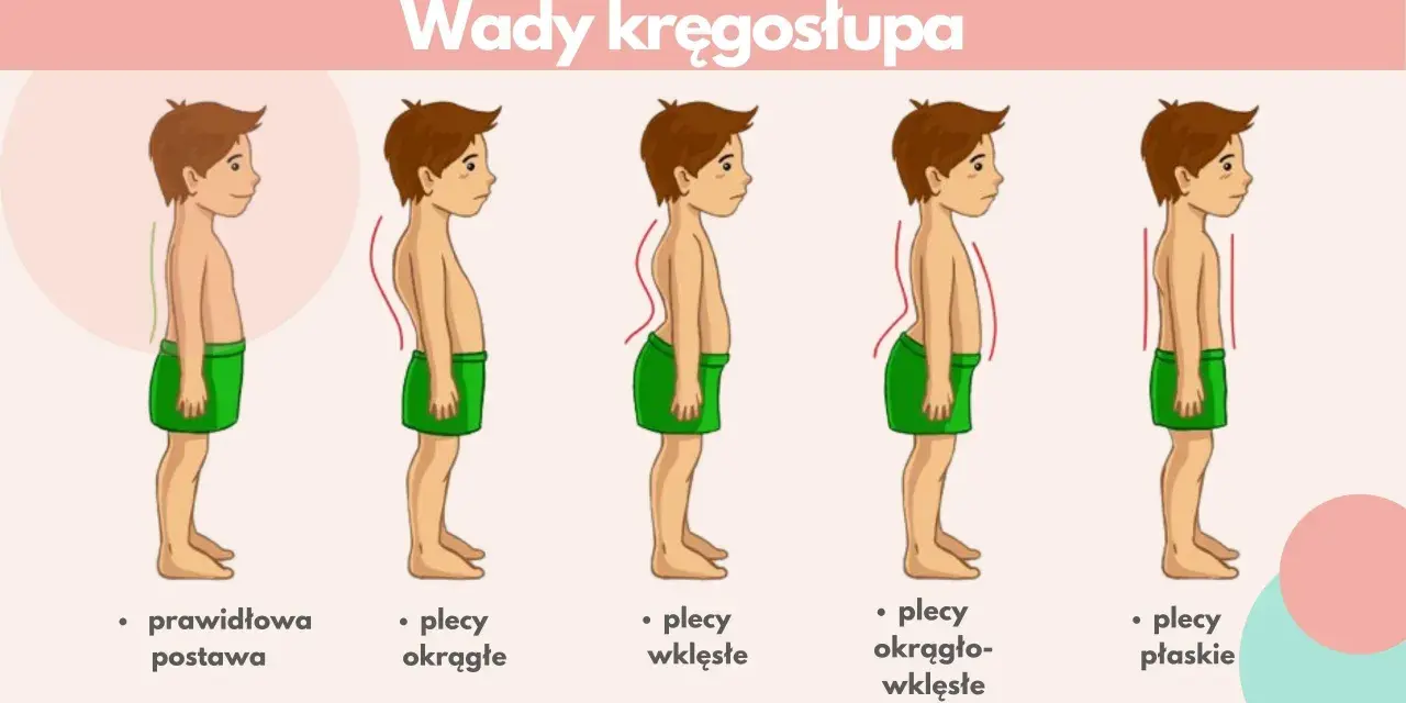 Ilustracja pokazuje wady kręgosłupa: plecy okrągłe, wklęsłe, okrągło-wklęsłe i płaskie, obok prawidłowej postawy.