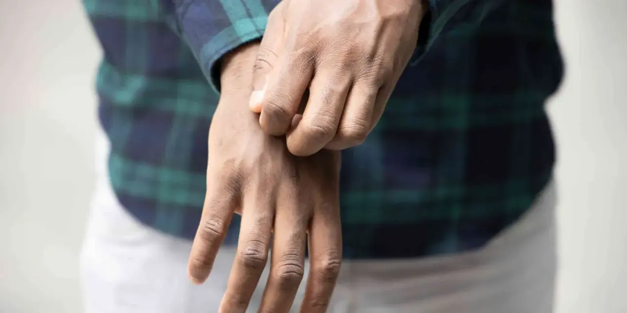 Uomo con camicia a quadri che si gratta il polso, soffrendo di prurito in tutto il corpo.