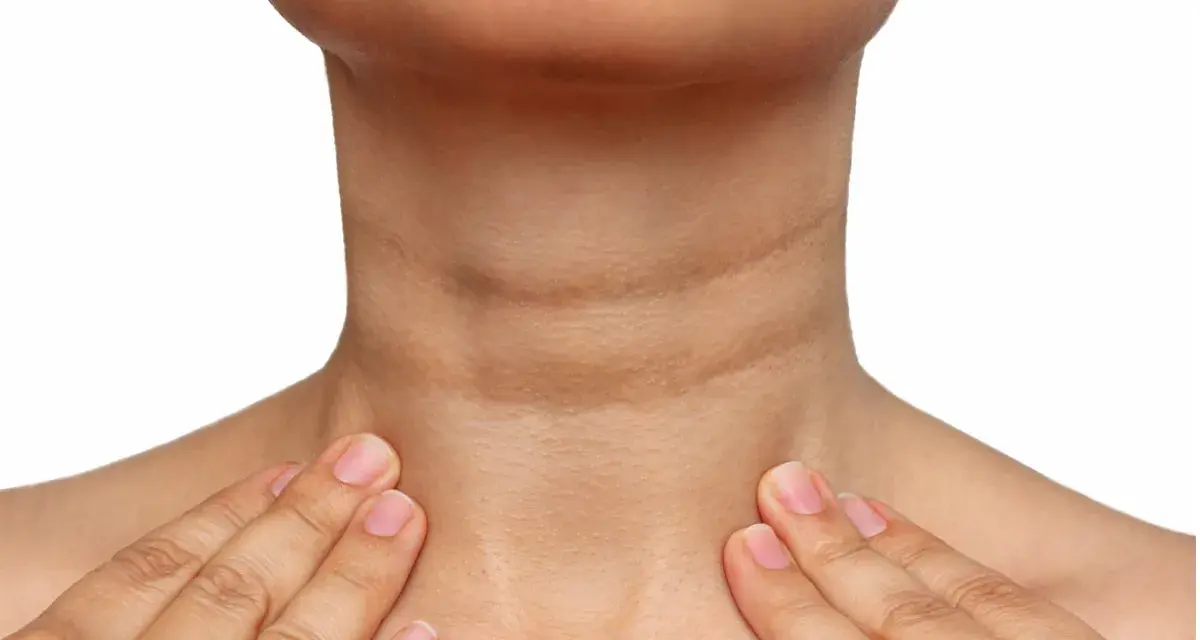 Cuello con piel oscura y arrugada, indicativo de acantosis nigricans. Se buscan opciones de tratamiento.