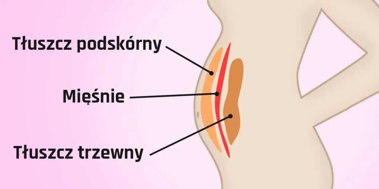 Ilustracja pokazuje przekrój brzucha, gdzie widać jak wygląda tłuszcz na brzuchu: podskórny i trzewny, oddzielone mięśniami.