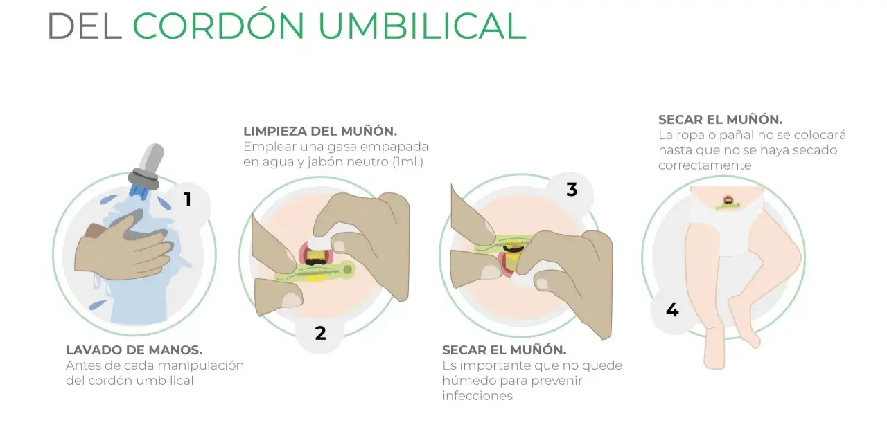 Guía para saber como limpiar el ombligo del bebe: lava manos, limpia el muñón con gasa y jabón neutro, sécalo bien para prevenir infecciones.