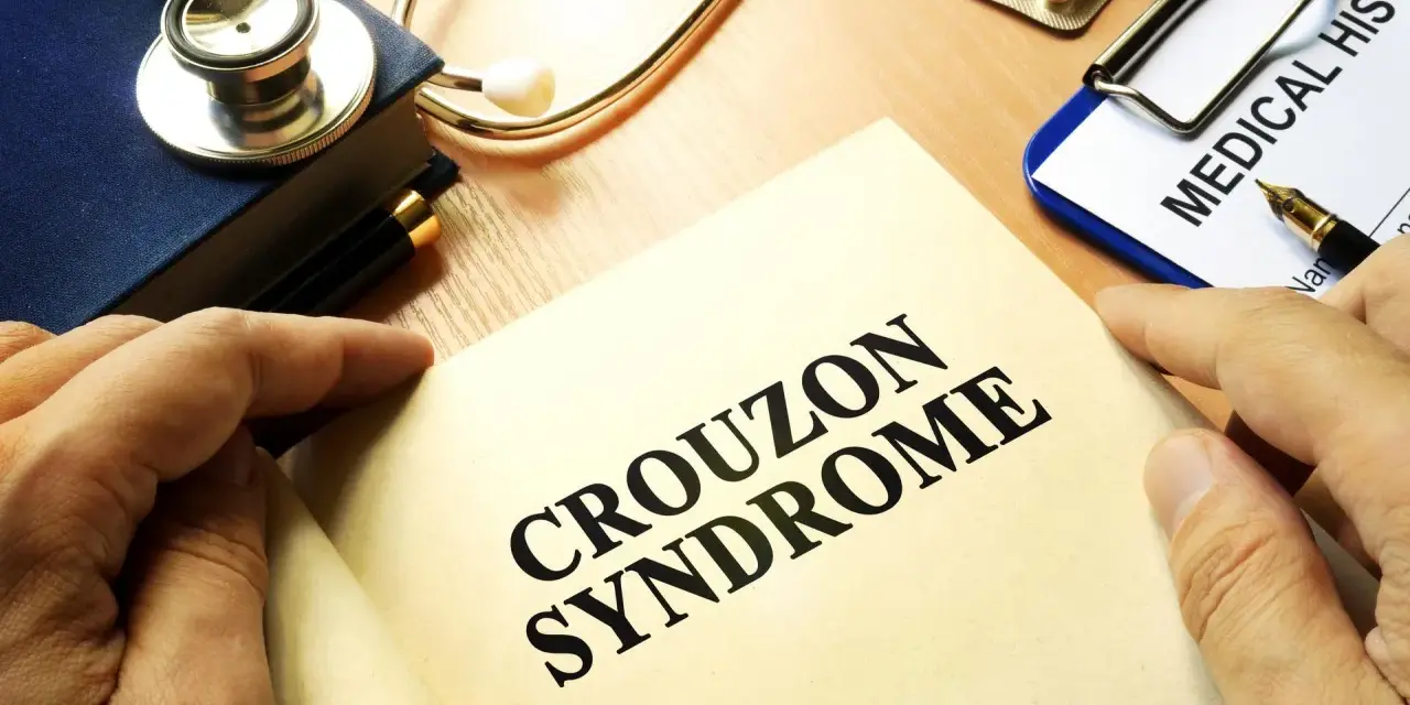 Książka z napisem "CROUZON SYNDROME", stetoskop, dokument "MEDICAL HISTO" i lekarstwa.