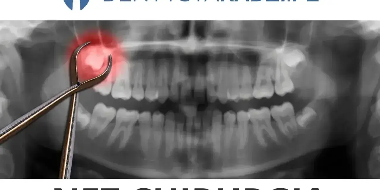 RTG szczęki z kleszczami dentystycznymi i zaznaczonym bólem. Gdzie wyrwać zęba w Łodzi na NFZ? NFZ Chirurgia.