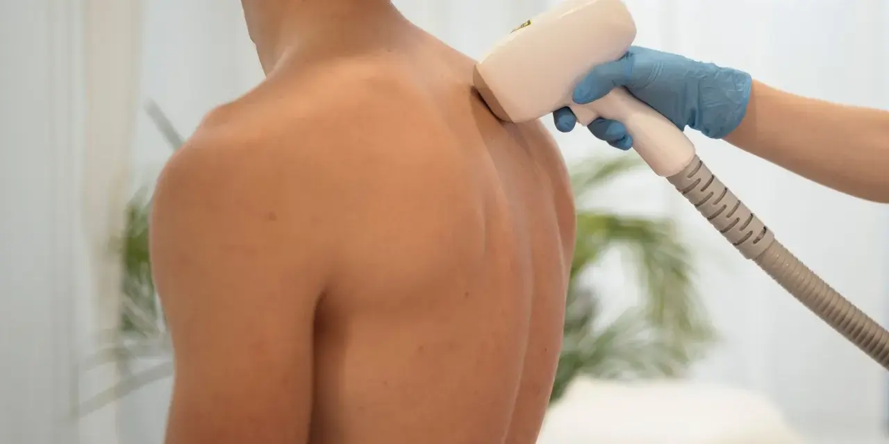 Zabieg depilacji laserowej pleców u mężczyzny. Włosy na plecach u mężczyzn przyczyny mogą być różne, ale nowoczesne metody pozwalają na trwałe ich usunięcie.