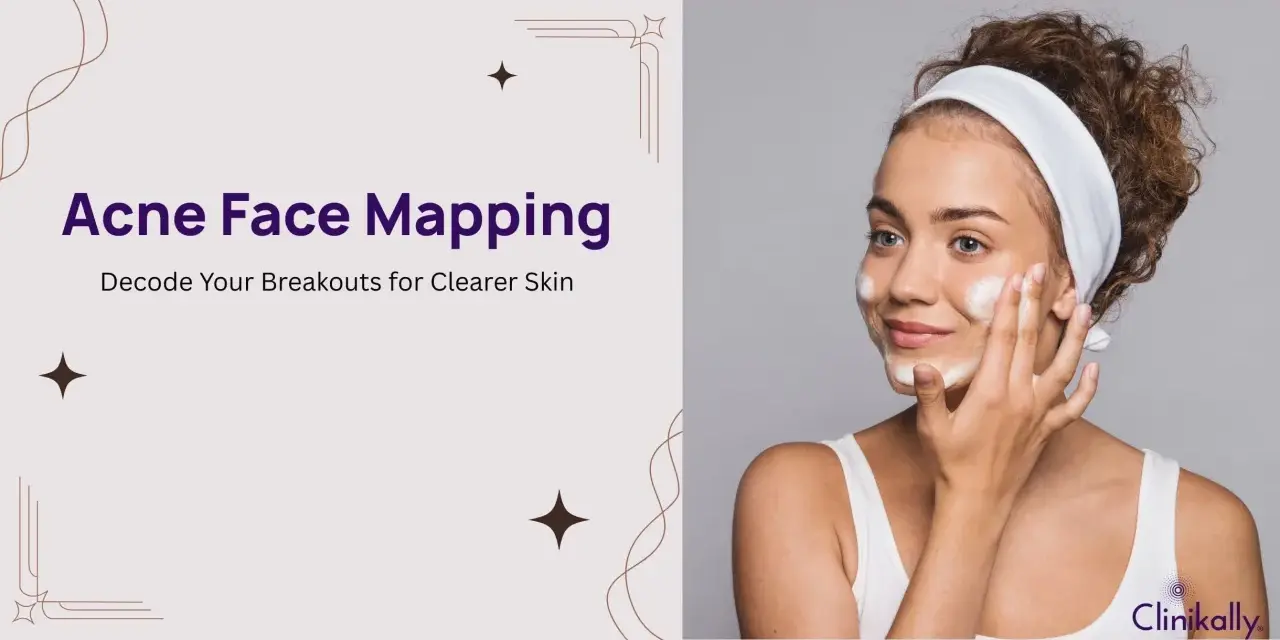 A woman applies foam to her face, illustrating the concept of acne face mapping to understand breakouts.