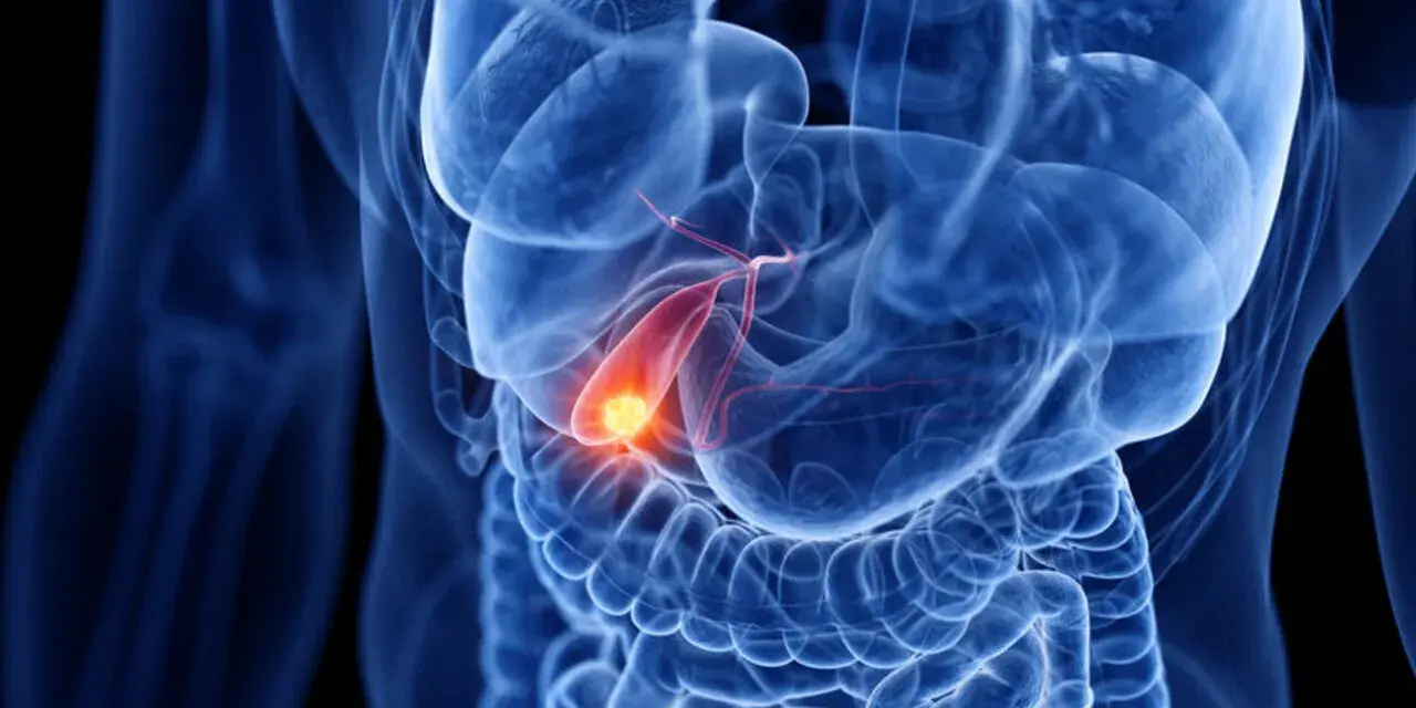 Anatomical rendering of a human torso showing the digestive system. A glowing yellow object, representing a gallstone, is visible within the **woreczek żółciowy**.