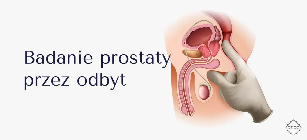 Ilustracja anatomiczna męskiego układu rozrodczego z badaniem per rectum.
