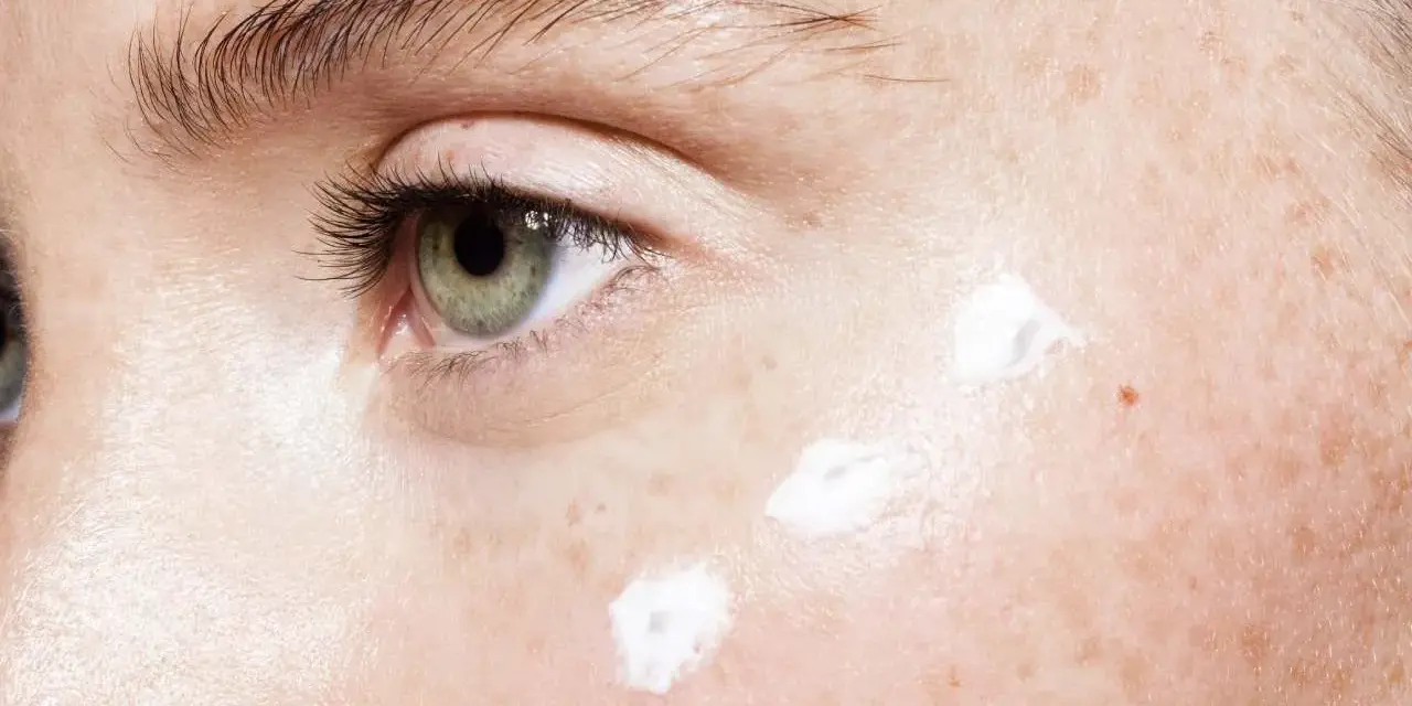 Nahaufnahme eines Auges mit Sommersprossen und drei Tupfern weißer Creme, die auf die Haut aufgetragen werden. Mögliche Ursachen für feuchte Haut.