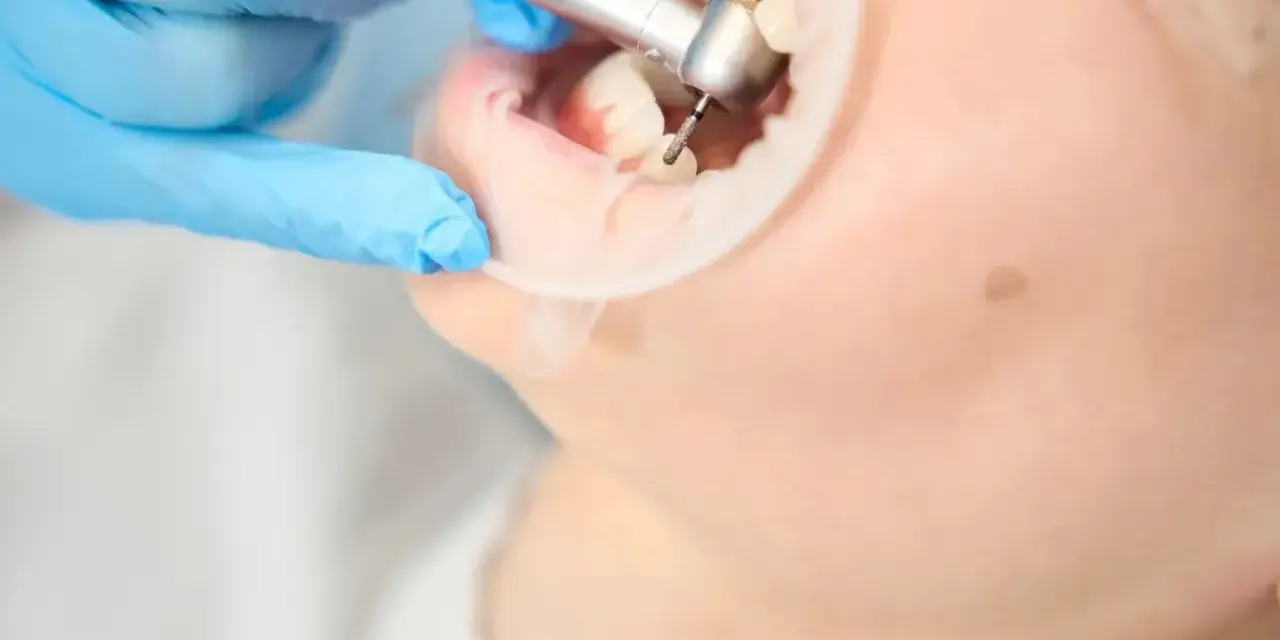 Co dentysta wkłada w zębodół po ekstrakcji? Wszystko, co musisz wiedzieć