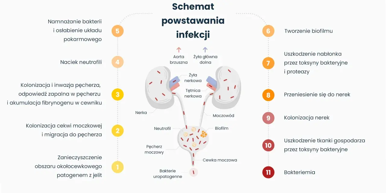 Schemat powstawania infekcji, od zanieczyszczenia do zapalenia pęcherza i nerek. Bakterie uropatogenne kolonizują cewkę moczową, pęcherz, a następnie nerki.