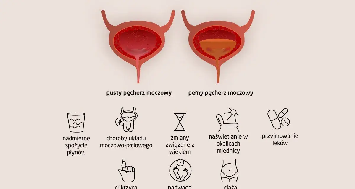 Ilustracja pokazuje przyczyny częstego oddawania moczu: nadmierne picie, choroby układu moczowo-płciowego, wiek, naświetlanie, leki, cukrzyca, nadwaga, ciąża.