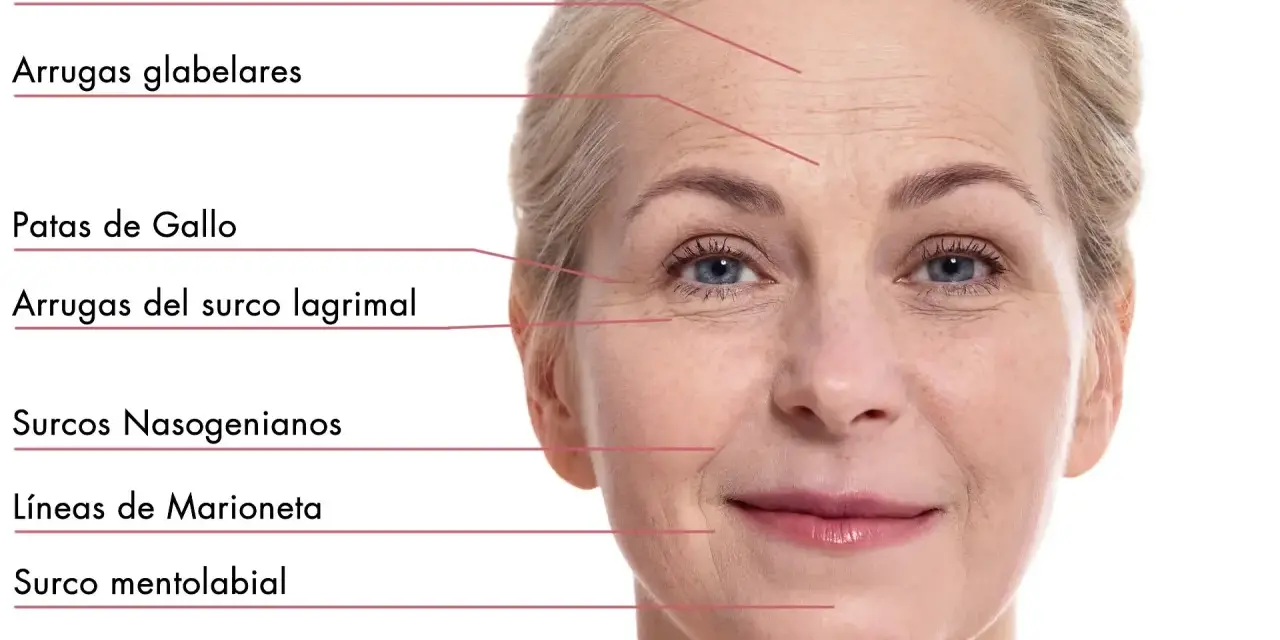 Rostro de mujer con líneas de expresión marcadas, mostrando arrugas estáticas en frente, ojos y alrededor de la boca.