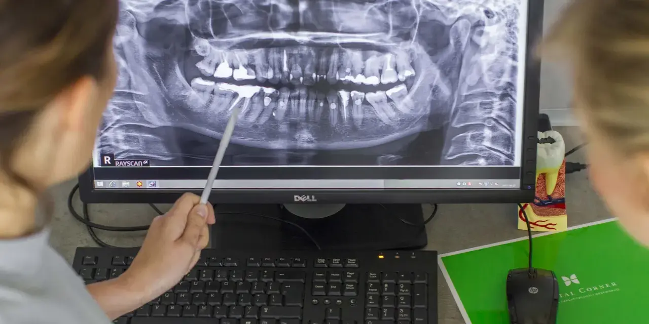 Górna dwójka: Jeden kanał to norma? Sprawdź, co mówi dentysta