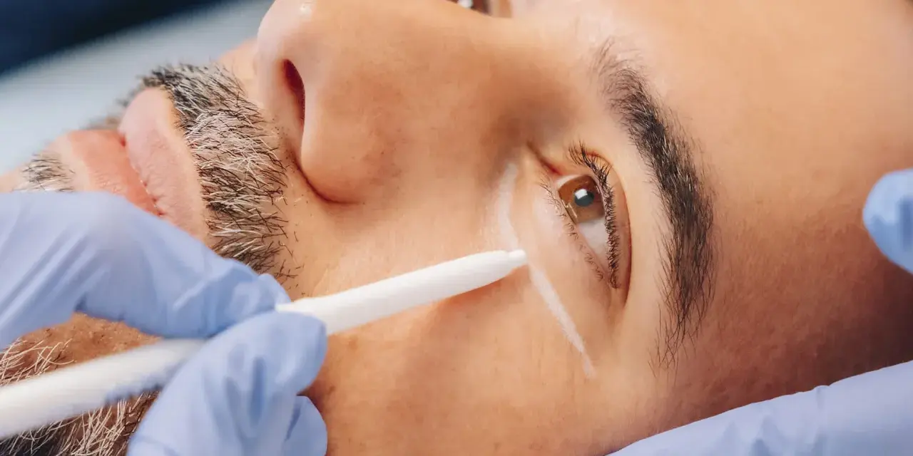 Man receiving treatment to eliminate dark circles permanently. A gloved hand holds a device near his eye.