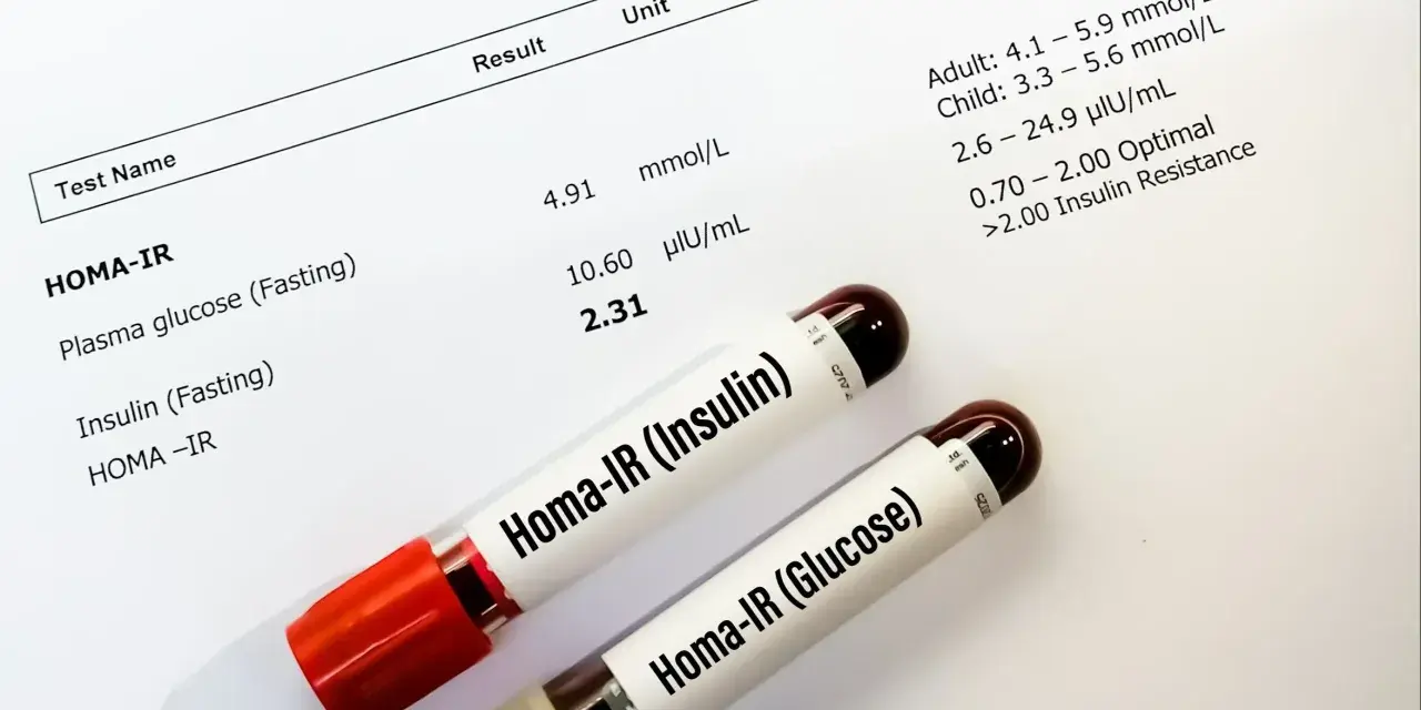 Wyniki badań HOMA-IR, wskazujące na insulinooporność. Dwie probówki z próbkami krwi.