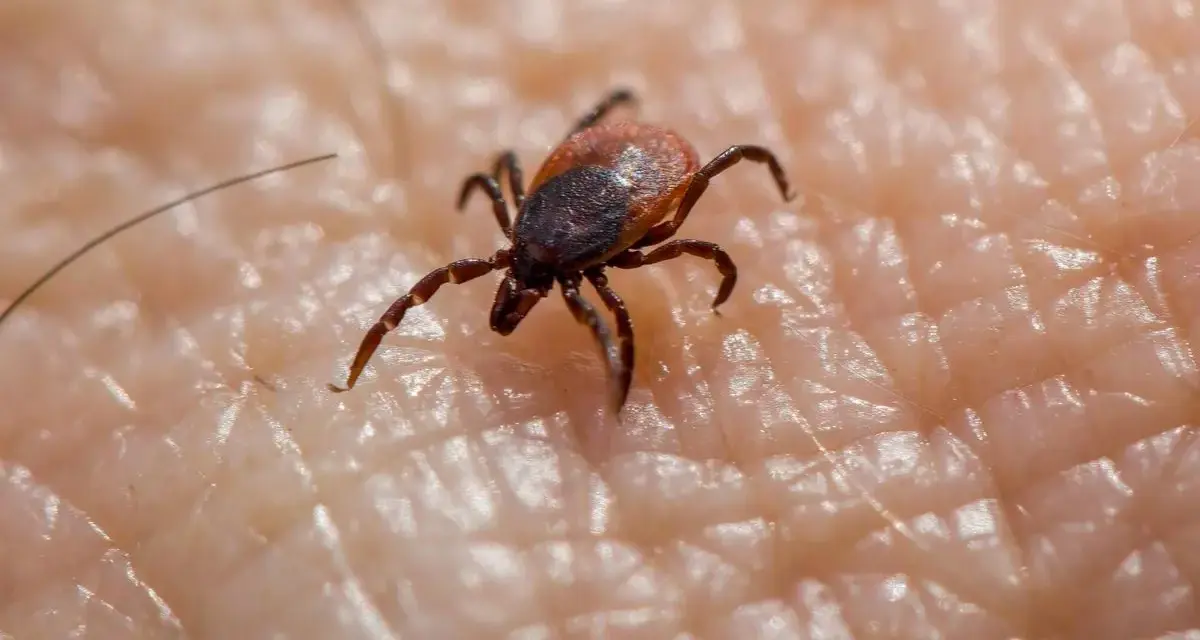 Garrapata en piel humana, un ejemplo de los tipos de garrapatas en España.