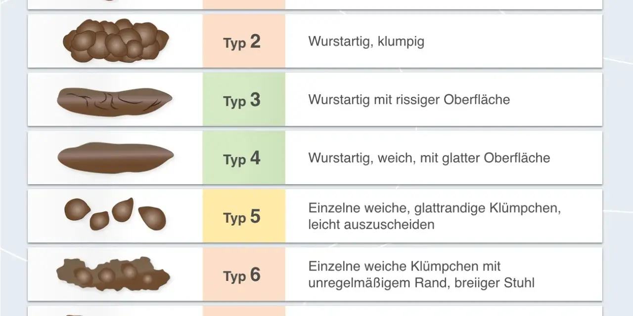 Typ 6 zeigt einzelne weiche Klümpchen mit unregelmäßigem Rand, was auf breiigen Stuhlgang hindeutet. Die Abbildung vergleicht verschiedene Stuhlformen.