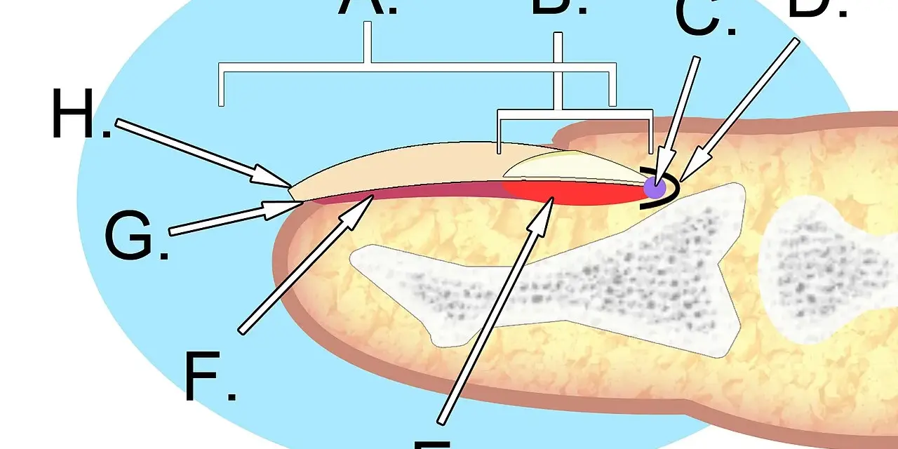 Schéma illustrant l'anatomie de l'ongle, montrant ses différentes parties et structures sous-jacentes.