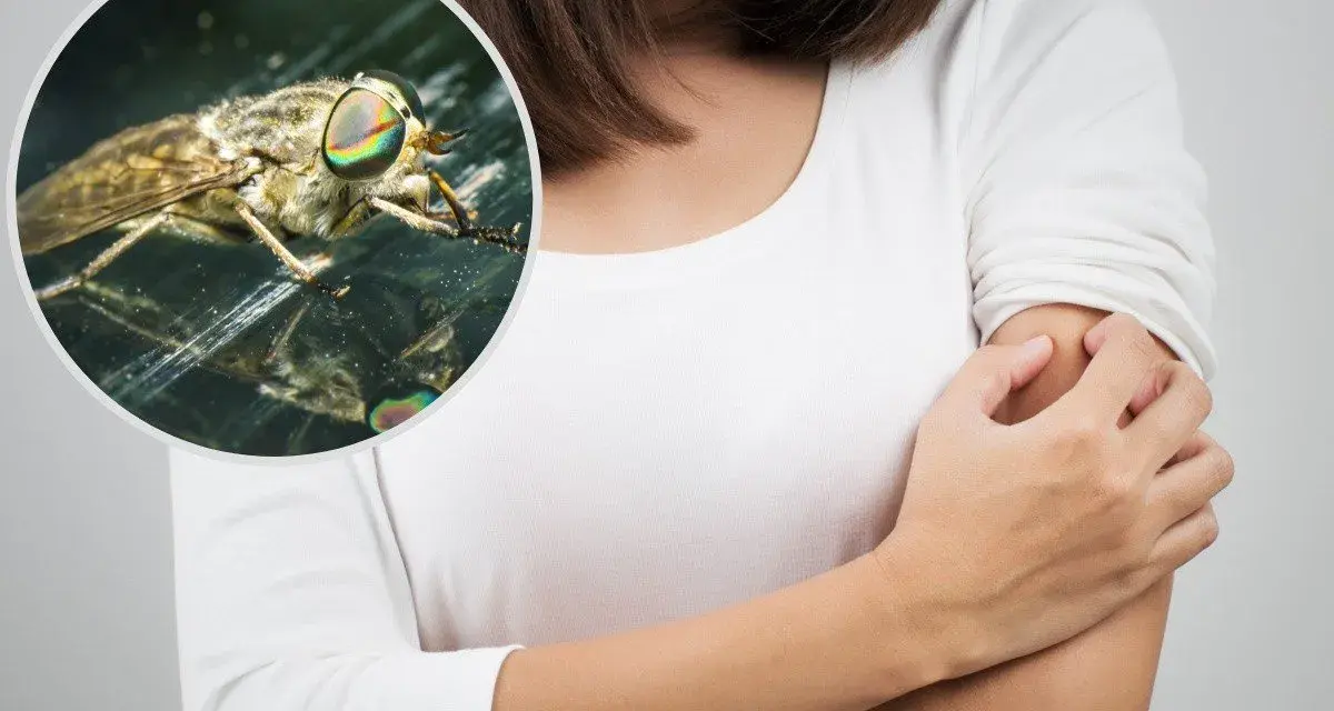Kobieta drapie ramię po ugryzieniu muchy końskiej. Widok z bliska na owada z tęczowymi oczami.