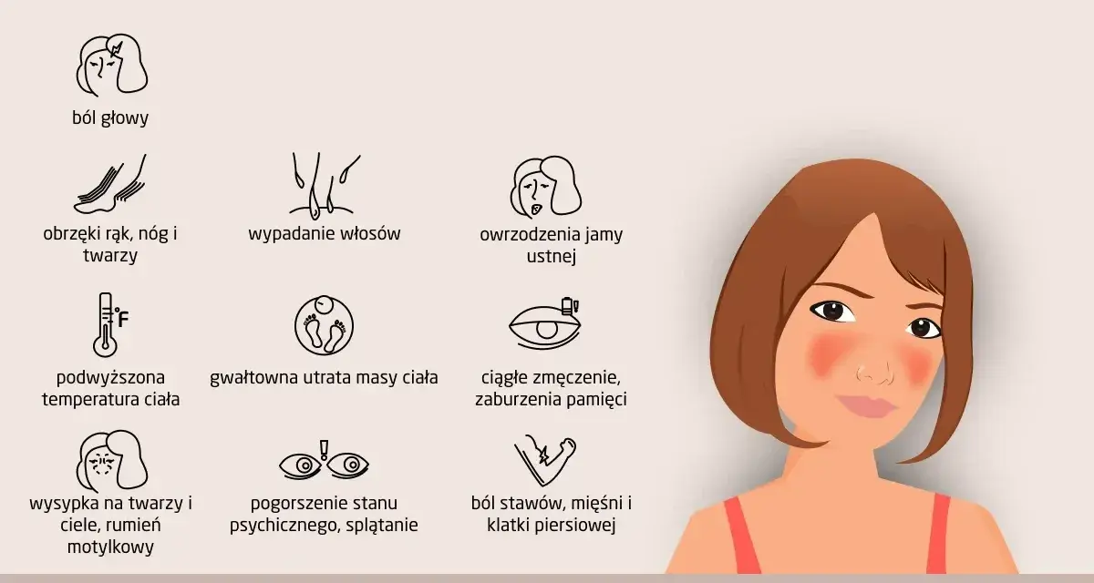 Ilustracja przedstawia objawy tocznia rumieniowatego układowego: ból głowy, obrzęki, wypadanie włosów, owrzodzenia, gorączkę, utratę wagi, zmęczenie, wysypkę motylkową, problemy ze wzrokiem i bóle stawów.