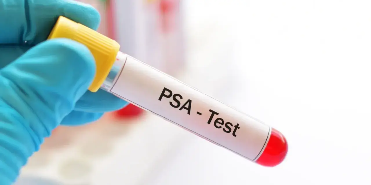 Blauer Handschuh hält Röhrchen für PSA-Test. Der PSA-Wert ist normal, was für die Gesundheit spricht.