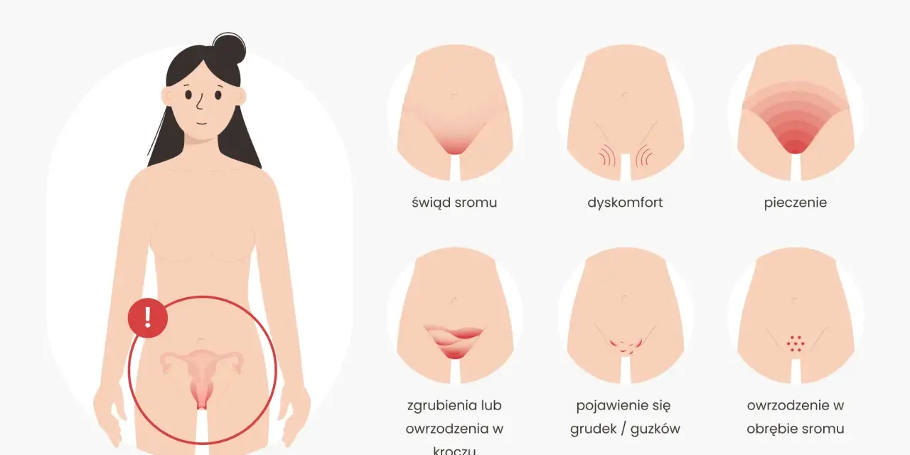Wczesne objawy raka sromu: świąd, pieczenie, dyskomfort, zgrubienia, grudki, owrzodzenia. Zwróć uwagę na zmiany.