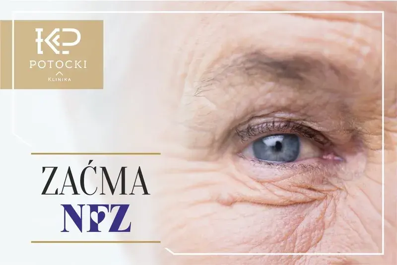 Zaćma: NFZ czy prywatnie? Gdzie najlepiej operować? Poradnik