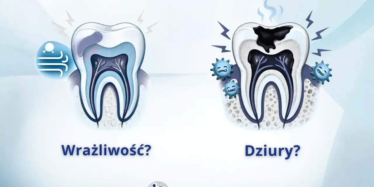 Zdrowy ząb po lewej, zniszczony przez próchnicę po prawej. Czy próchnica śmierdzi? Tak, a te uśmiechnięte bakterie to potwierdzają.